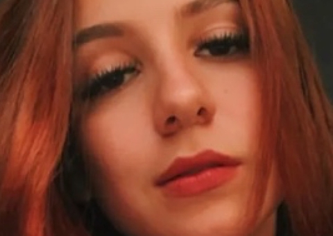 Motociclista atropela onça pintada e fica com rosto desfigurado