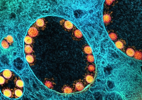 Fiocruz aponta aumento de casos de Covid no Amazonas e mais 11 estados