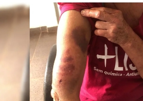 Polícia salva mulher torturada e queimada com 1 litro de óleo quente pelo próprio marido