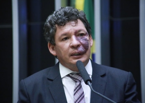 Bolsa Família fora do teto por 1 ano é irresponsabilidade, diz líder do PT