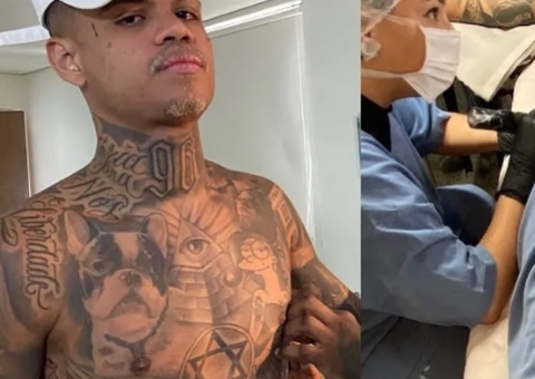 MC Cabelinho toma anestesia geral para terminar tatuagem nas costas