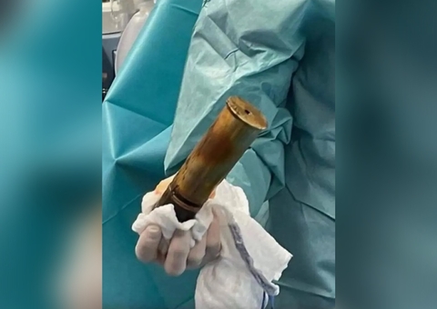 Homem tem projétil de bomba enfiado no ânus e faz hospital ser evacuado