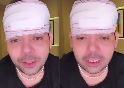 Humorista Gustavo Mendes leva pedrada na cabeça durante tentativa de assalto