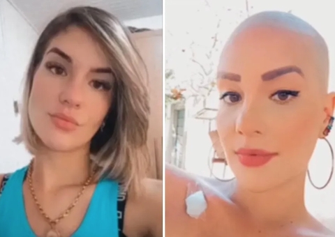 Mulher raspa o cabelo para fingir ter câncer e aplicar golpes com rifas e doações