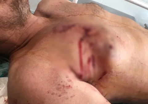 Jacaré ataca e arrasta pescador para o fundo do rio