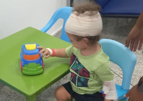 Menino tem parte do rosto dilacerado após ataque de cachorro