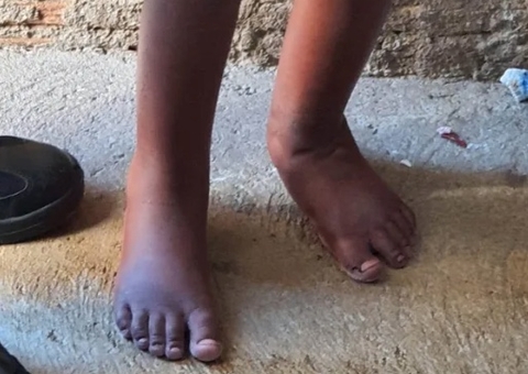 Menino aguarda adoção 2 anos após ser resgatado dentro de barril