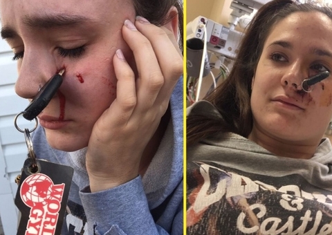 Chave fica cravada no rosto de motorista após ser arremessada por amiga