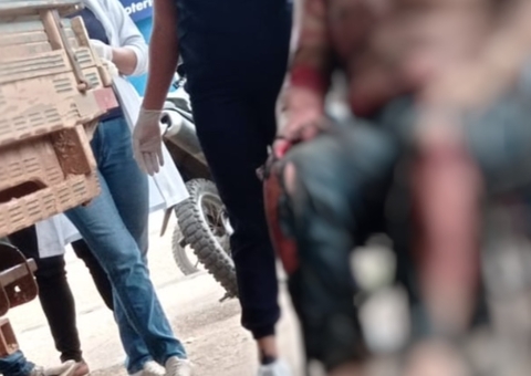 Avião cai no Amazonas e piloto tem corpo tomado por chamas