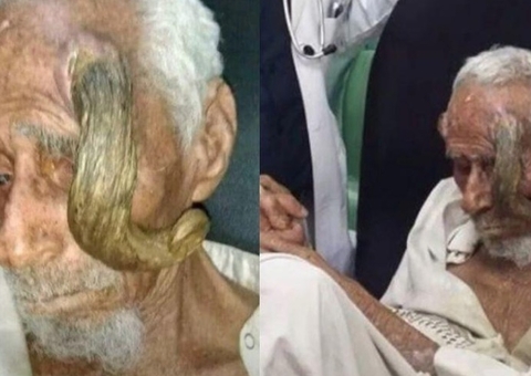 Idoso de 140 anos morre após desconhecido tentar arrancas seus 'chifres'