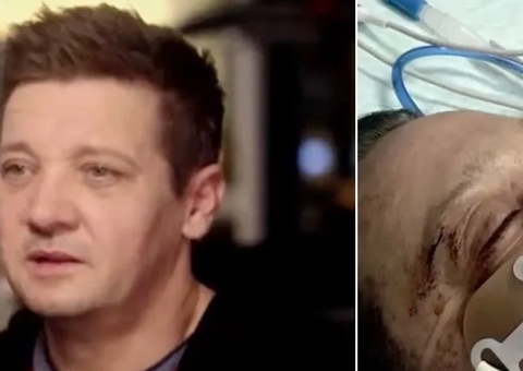 Jeremy Renner divulga novas imagens do grave acidente de snowcat: 'lutando para respirar'