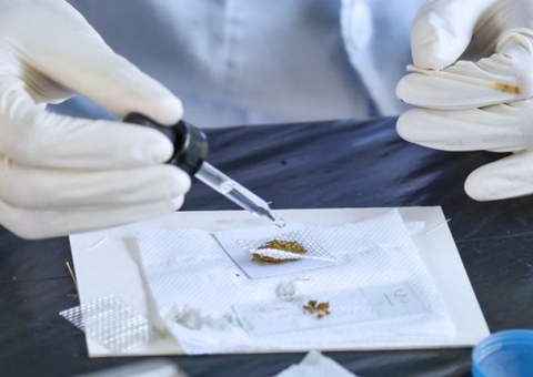 Exame pioneiro detecta parasitas intestinais em apenas 5 minutos; veja