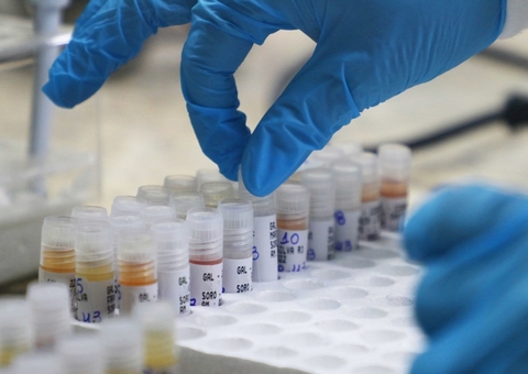 Amazonas segue sem novos casos de Mpox; confira 