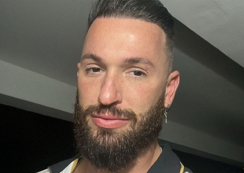 Diego Hypolito faz nova harmonização facial e mostra resultado