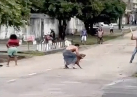 Vídeo mostra pitbulls de vereador atacando diarista