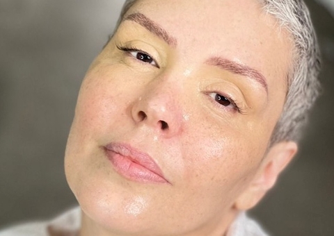 Simony retoma tratamento contra câncer: ‘mais essa luta’