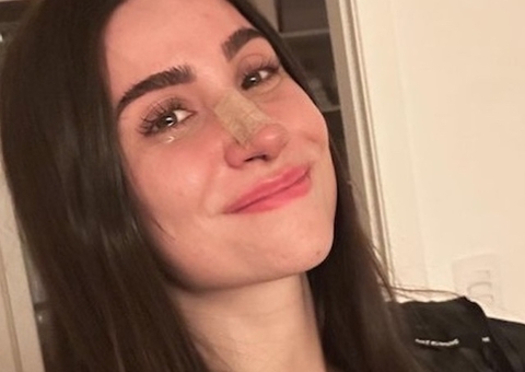 Bianca Andrade surge com nariz empinado após rinoplastia; veja o antes e depois 