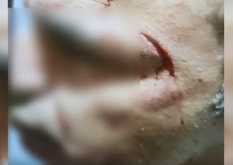 Vizinho é recebido com enxadada na cabeça ao reclamar de som alto