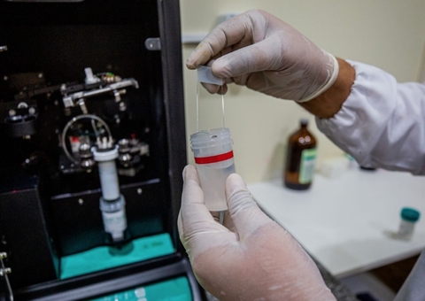 Manaus inicia exame preventivo com maior eficácia no diagnóstico até fim de maio