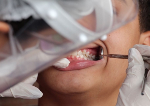 Governo relança hoje o programa Brasil Sorridente