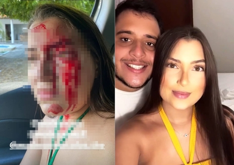 Filho de delegado é preso suspeito de agredir namorada