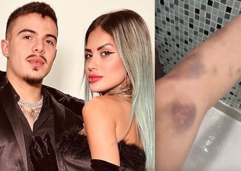 Tati Zaqui denuncia Thomaz Costa à polícia por agressões; veja fotos
