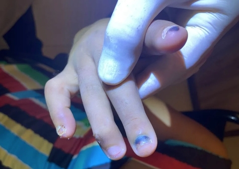 Cadeirante é resgatada após 4 anos sendo torturada pela irmã; vítima teve unhas arrancadas