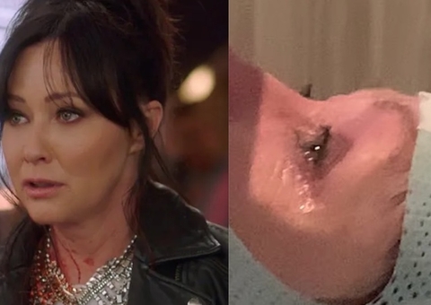 Shannen Doherty, de ‘Barrados no Baile’, diz que câncer se espalhou para o cérebro 