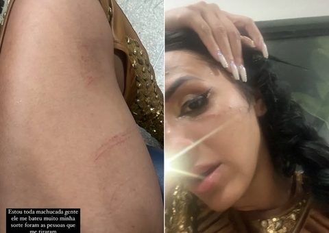 Irmã de Deolane quebra dente e vai à delegacia após briga com Rico; vídeo