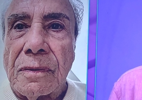 Stenio Garcia faz harmonização facial aos 91 anos e choca com resultado