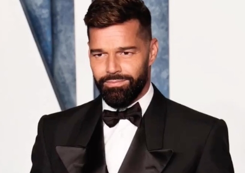 Argentino faz mais de 30 cirurgias para se parecer com Ricky Martin 