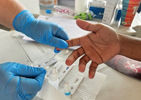 Parintins faz teste de HIV e distribui 30 mil preservativos em companha contra IST’s
