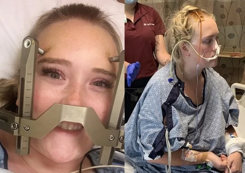 Aos 22 anos, jovem sofre AVC após bater a cabeça