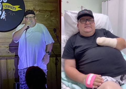 Influencer tem mão amputada após acidente com fogos de artifício