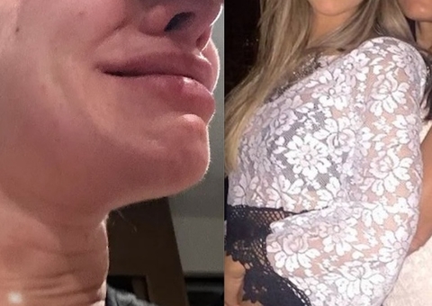 Mãe de ex-BBB é feita refém durante assalto: ‘cinco horas amarrada’ 