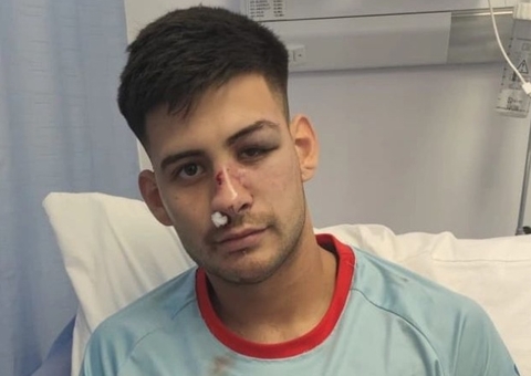 Jogador fratura o nariz após levar chute no rosto na Argentina