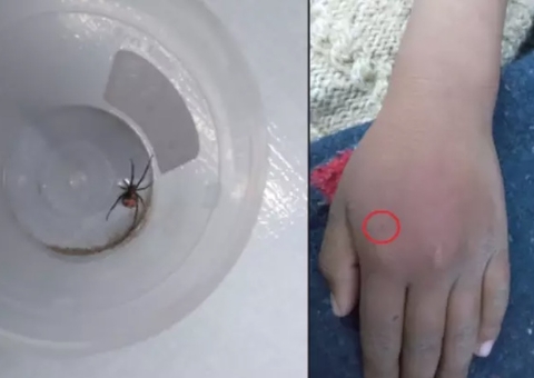 Criança é picada por viúva-negra e diz que queria virar o Homem-Aranha