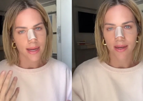 Gio Ewbank passa por cirurgia de desvio de septo e revela crises de ansiedade