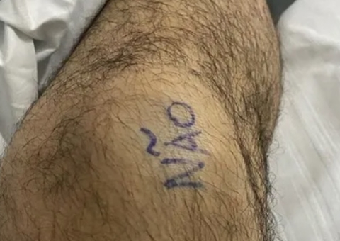Paciente escreve ‘sim’ e ‘não’ nos joelhos para evitar erro em cirurgia 