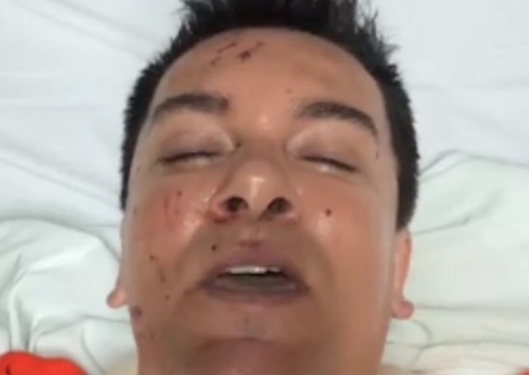 Regis Danese teve perfuração no intestino, diz filho do cantor 