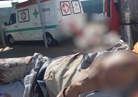 Metalúrgico tem parte do braço arrancado após ficar prensado em máquina