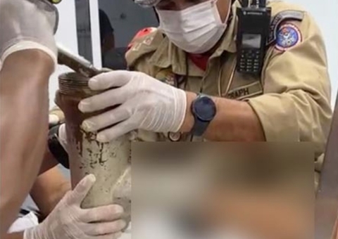 Funcionário de supermercado tem mão triturada em máquina de moer carne em Manaus