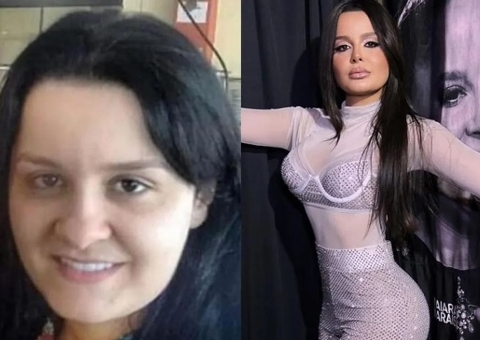 Antes e depois de Maraisa viraliza e choca fãs; Veja