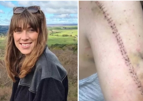 Mulher descobre que não tinha câncer após dois anos de tratamento