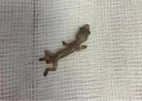 Criança fica em estado grave após ser obrigada pela madrasta a comer lagartixa