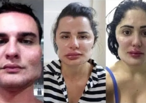 Médico é condenado por deformar rostos de pacientes com procedimentos estéticos