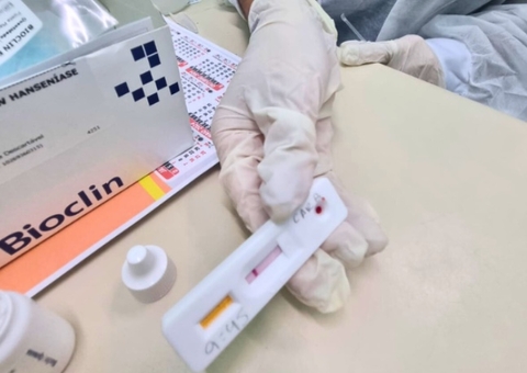 Fundação Alfredo da Matta inicia testagem rápida de Hanseníase