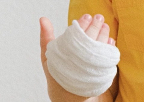 Pai e madrasta são indiciados após criança ter corpo queimado com colher quente em Manaus