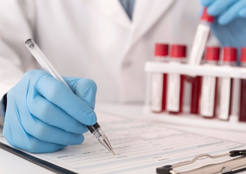 Pacientes do Amazonas com suspeita de câncer devem receber exames em até 30 dias