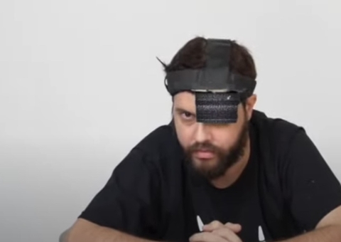 Diogo Defante faz 'chá revelação' de cirurgia no olho; veja como ficou 